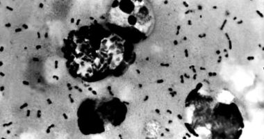 Case Of Bubonic Plague Detected In United States