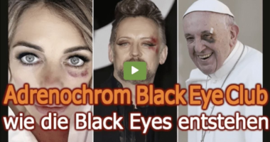 Have You Heard Of The “Black Eye Club”?