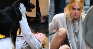 Nicole Kidman sports bloody knee while filming alongside dog for new movie 'Babygirl'