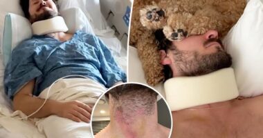 Val Chmerkovskiy shows neck injury that led to hospitalization