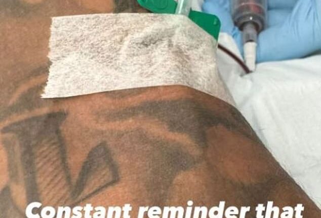 Actor Nick Cannon undergoes blood treatment amid ongoing battle with the autoimmune disease lupus