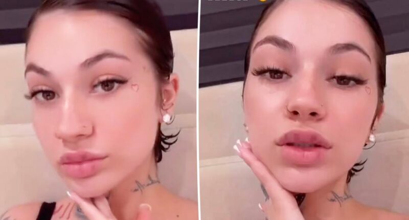 Bhad Bhabie dissolved her fillers, warns people to stop getting them