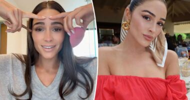 Botox, filler, buccal fat removal