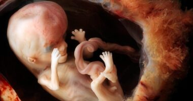 Florida Supreme Court Upholds 15-Week Abortion Ban, Opens Door For “Pro-Abortion Amendment”
