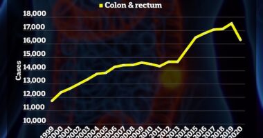 The above graph shows colon cancer cases among under 50s rising by more than 5,500 in 20 years. There is a drop in 2020 because the Covid pandemic led to fewer people coming forward for screenings.