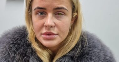 Lillie Barrett, 22, from Welling in South East London, forked out on a pricey pair of Russian lash extensions but began to experience an itchy left eye shortly after, and was even temporarily left blinded