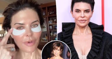Lisa Rinna admits facial fillers were 'not good for me' after critics slammed her look
