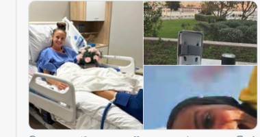 Super Falcons defender, Plumptre undergoes successful surgery