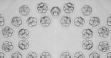 Why Are Louisiana Lawmakers Pushing Immunity For Embryo Killing?