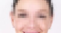 A woman who paid over $100,000 for veneers at a clinic in Turkey has been left gobsmacked after being given the wrong type of surgery which fell out a  month later (stock image)