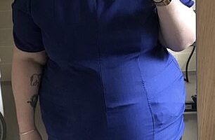 Rosie Whitney (pictured) before her weight loss