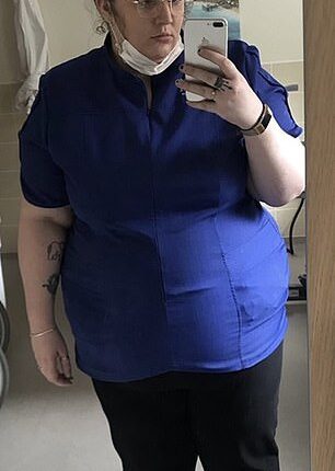 Rosie Whitney (pictured) before her weight loss