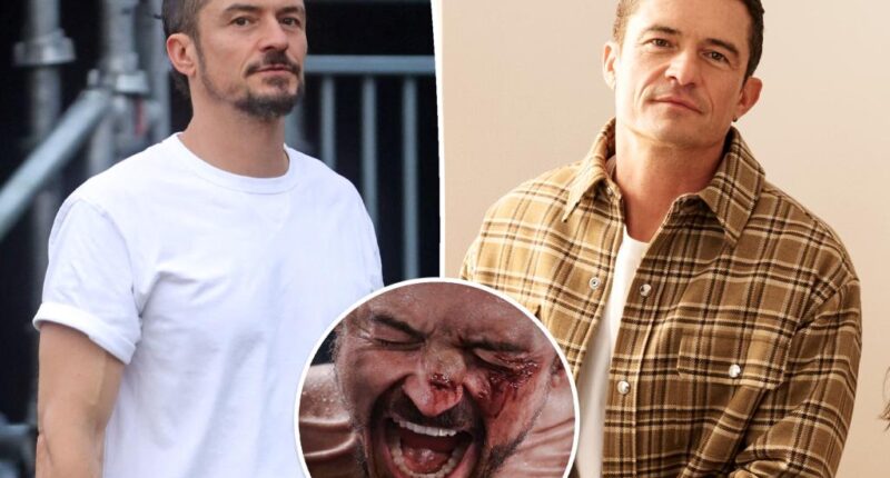 Orlando Bloom thought he was going to ‘die’ due to drastic weight loss for movie role