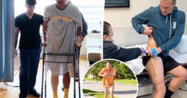 Ryan Lochte shows 10-month recovery journey after breaking his leg in car accident