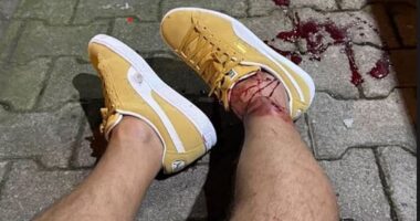 Serhat Akin confirmed he was shot after working as a pundit last night, and posted this graphic photo of blood coming from his right foot, with a trail of blood on the floor next to him