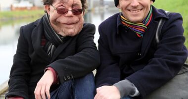 Adam (pictured left) and Neil Pearson (pictured right) in the documentary Horizon: My Amazing Twin