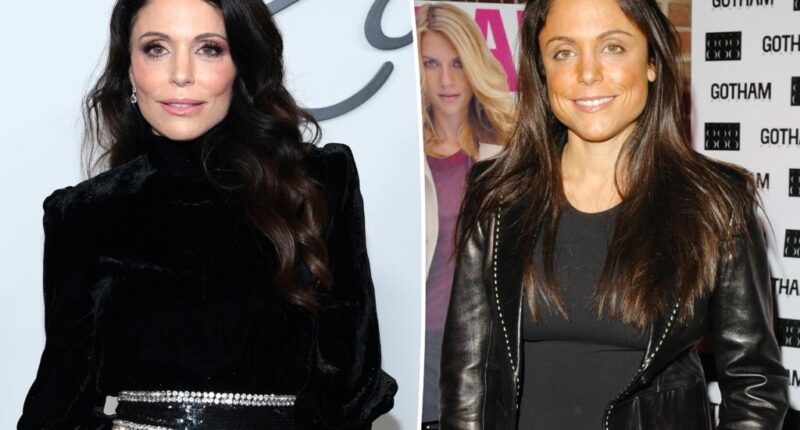 Haters are 'mad' I 'look better' with Botox