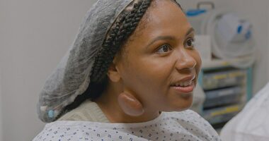 Olivia, 28, from Dudley in the West Midlands, had life-changing surgery to remove a massive golf ball sized growth from her neck which had been growing for over four years
