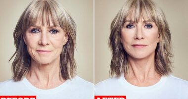 High Street designer Karen Millen, 63, pictured before and after her facelift operation which she had done at the Cadogan Clinic in Chelsea, west London