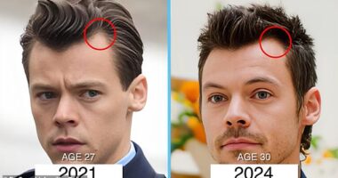 Dr Gary Linkov, based in New York City, pointed to these photos from 2021 and 2024 as possible signs Harry Styles had undergone a minor hair transplant