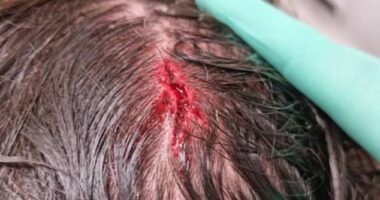 Zlatan Ibrahimovic showed off a nasty gash on his head and wrote: 'Part of the game'