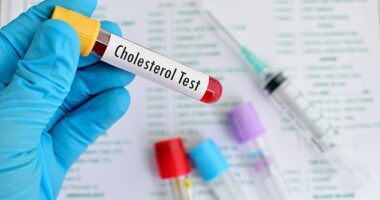 A 5-minute cholesterol check could spot if dementia will strike in 6 years time, experts find