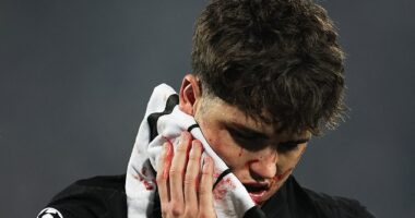 Pau Cubarsi suffered a nasty facial injury during Barcelona's 5-2 win over Crvena zvezda