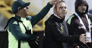 Mexican national team coach Javier Aguirre was left bloodied after being hit with a beer can