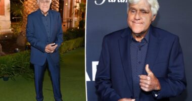 Jay Leno hits red carpet in Las Vegas with swelling, bruises after nasty fall