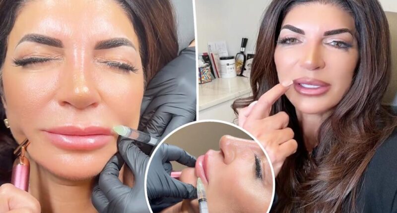 Teresa Giudice reveals she is dissolving her lip filler