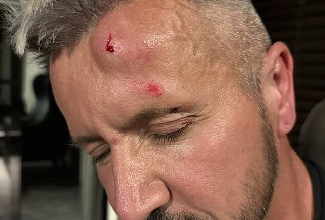 Interior designers Wesley Fellows and Peter Snowdon, from Shropshire, were staying in the city to see friends when they reported being assaulted by four men