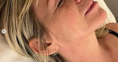 Zoe Ball has revealed she has been battling a painful health condition most days which has left her with 'awful' headaches