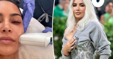 Kim Kardashian shares $4K laser treatment ahead of Met Gala 2025