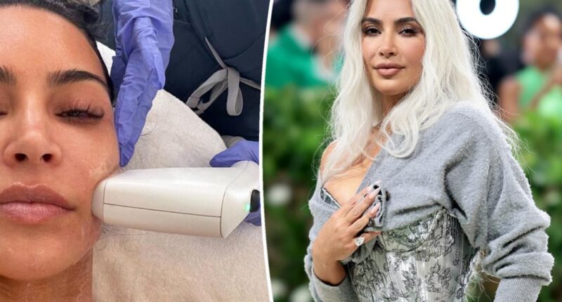 Kim Kardashian shares $4K laser treatment ahead of Met Gala 2025