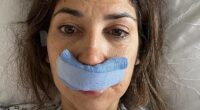 Real Housewives Of Cheshire star Leilani Dowding concerns fans as she shares bandaged face photo from hospital bed after undergoing surgery