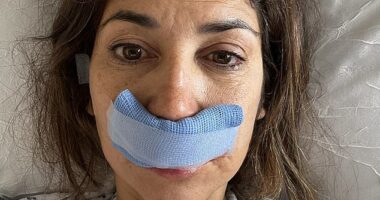 Real Housewives Of Cheshire star Leilani Dowding concerns fans as she shares bandaged face photo from hospital bed after undergoing surgery