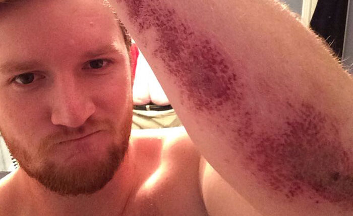 72 Epic Fails and Hilarious Selfies Gone Totally Wrong