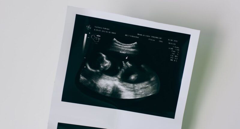 Congress Must Codify That Life Begins At Conception