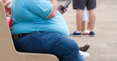 Denying joint operations to obese patients is counterproductive