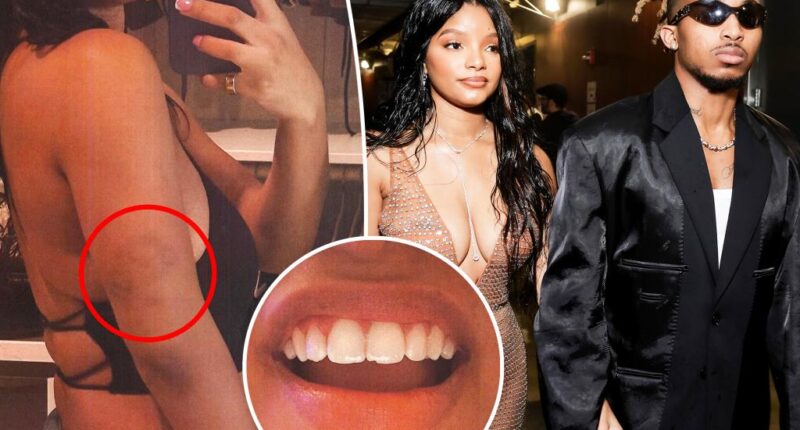 Halle Bailey claims ex DDG attacked her multiple times