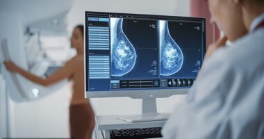 Screening programs, like The BreastScreen Australia Program, are designed 'find and treat cancers in healthy individuals as early as possible or, even better, in a precancerous stage,'  Cancer Council Australia's Cancer Screening and Immunisation Committee Chair Karen Canfell told FEMAIL