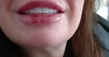 Marsha Thomas from Wrexham said she's 'drowning' in debt and in constant pain due to her botched Turkey teeth (pictured with her new teeth)