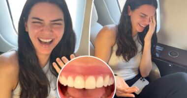 Kendall Jenner realizes she chipped her front tooth in video