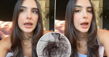 Kyle Richards' daughter Sophia shows off hair loss from weight-loss drug