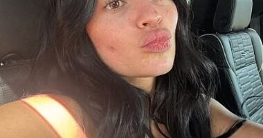 Kylie Jenner gets real about unfortunate blemish marring her makeup-free face