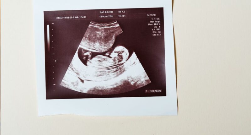 sonogram