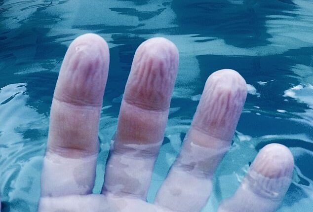 Most people will be familiar with the way our skin - especially on our fingers and toes - goes wrinkly after spending time in water