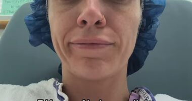 A woman has revealed how a simple splinter lead to nearly five years of excruciating pain, seizures, and eventually, a 'complete loss of control over her central nervous system'