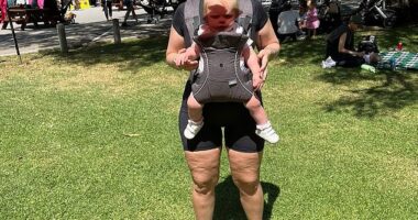 Perth mother Taylor O'Malley, 30, pictured with daughter Abigail, had her constant bruising and bigger, uneven toned legs dismissed as 'normal for her and her body'