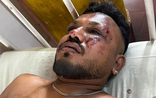 Brit Vishwash Kumar Ramesh, who was sitting in seat 11A, said it was a 'miracle' he survived last Thursday's disaster that killed 279 people